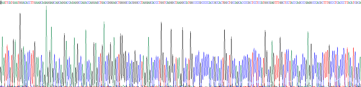 Recombinant Sphingosine Kinase 2 (SPHK2)