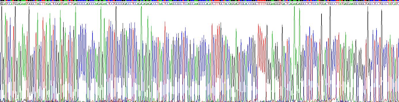 Recombinant Transient Receptor Potential Cation Channel Subfamily V, Member 1 (TRPV1)