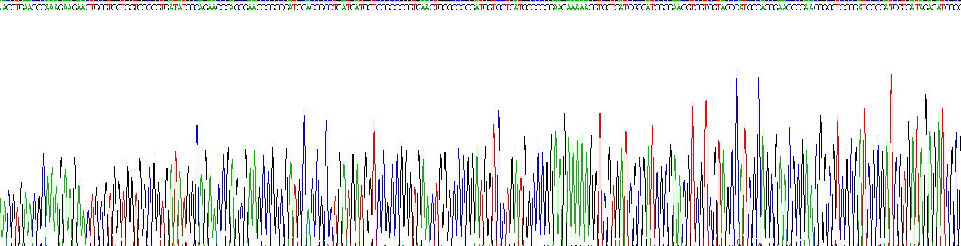 Recombinant Small Nuclear Ribonucleoprotein 70kDa (SNRNP70)