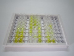 ELISA Kit for Nerve Growth Factor (NGF)