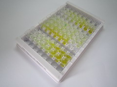 ELISA Kit for Immunoglobulin M (IgM)