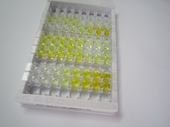 ELISA Kit for Retinol Binding Protein 4 (RBP4)