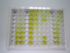 ELISA Kit for Deoxyribonuclease I (DNASE1)