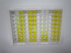 ELISA Kit for Electron Transfer Flavoprotein Beta Polypeptide (ETFb)