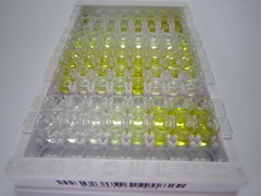 ELISA Kit for Very Low Density Lipoprotein (VLDL)