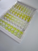 ELISA Kit for Creatine Kinase B (CK-BB)