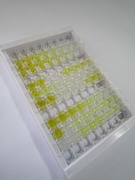 ELISA Kit for Corneodesmosin (CDSN)