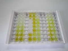 ELISA Kit for Fibulin 1 (FBLN1)