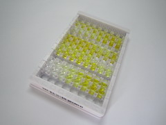 ELISA Kit for Platelet Derived Growth Factor Subunit B (PDGFB)