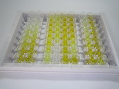 ELISA Kit for Complement Component 1, Q Subcomponent B (C1qB)