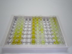 ELISA Kit for Neurofilament, Light Polypeptide (NEFL)