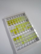 ELISA Kit for Aurora Kinase B (AURKB)