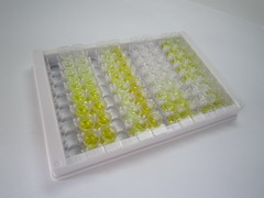 ELISA Kit for Suppressors Of Cytokine Signaling 1 (SOCS1)