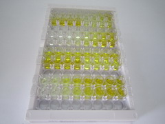 ELISA Kit for Renal Tumor Antigen (RAGE)