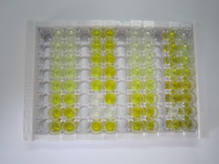 ELISA Kit for Nexilin (NEXN)