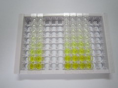 ELISA Kit for Glycosylphosphatidylinositol Anchored High Density Lipoprotein Binding Protein 1 (GPIHBP1)