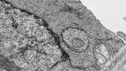 Transmission Electron Microscopy (TEM) Experiment Service